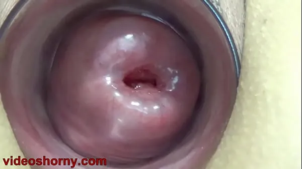 XXX Cervix Fucking pumped uterus prolapsed and t.. b. a. pussy and tormented top Videos