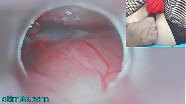 XXX Uncensored Japanese Insemination with Cum into Uterus and Endoscope Camera by Cervix to watch inside womb top Videos